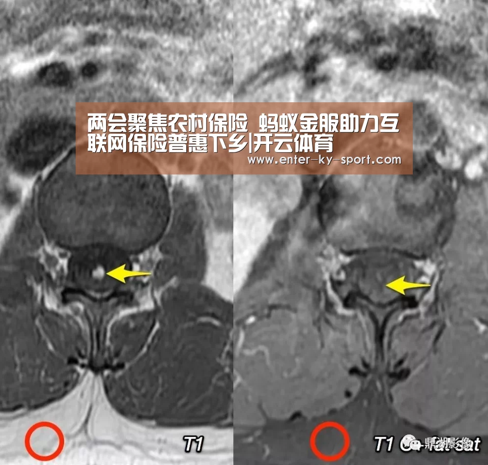 两会聚焦农村保险 蚂蚁金服助力互联网保险普惠下乡|开云体育(图3) 开云